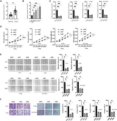 CircDTL Functions as an Oncogene and Regulates Both Apoptosis and Ferroptosis in Non-small Cell Lung Cancer Cells